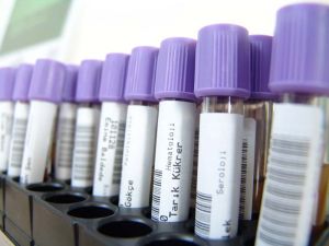 Test tubes alternate text for this image